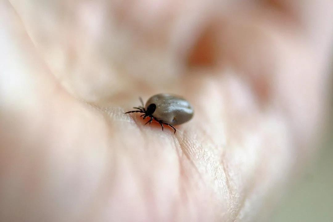 日本发现蜱虫传播的新型病毒